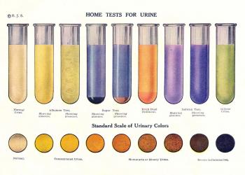 Par ko stāsta urīna krāsa